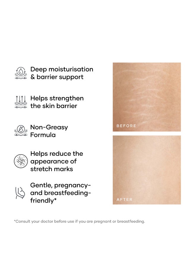 Cureskin Smoothing Body Butter Stretch Marks Cream for Women and Men | Stretch Marks Removal Cream for Women - Image 3